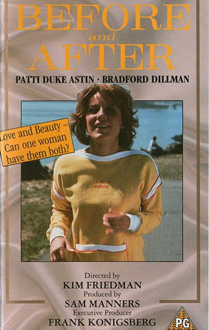 Before And After (1979) - Patti Duke  DVD